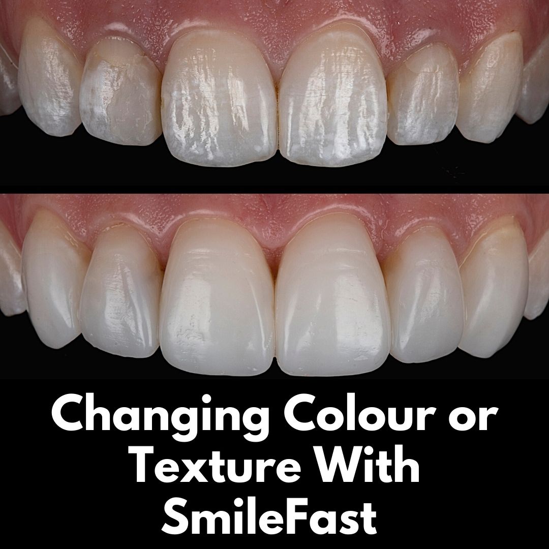 Oris Dental & Implant Studio SmileFast