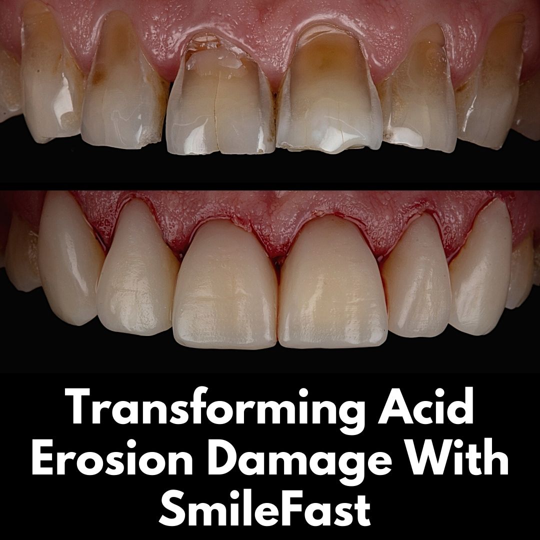 Oris Dental & Implant Studio SmileFast