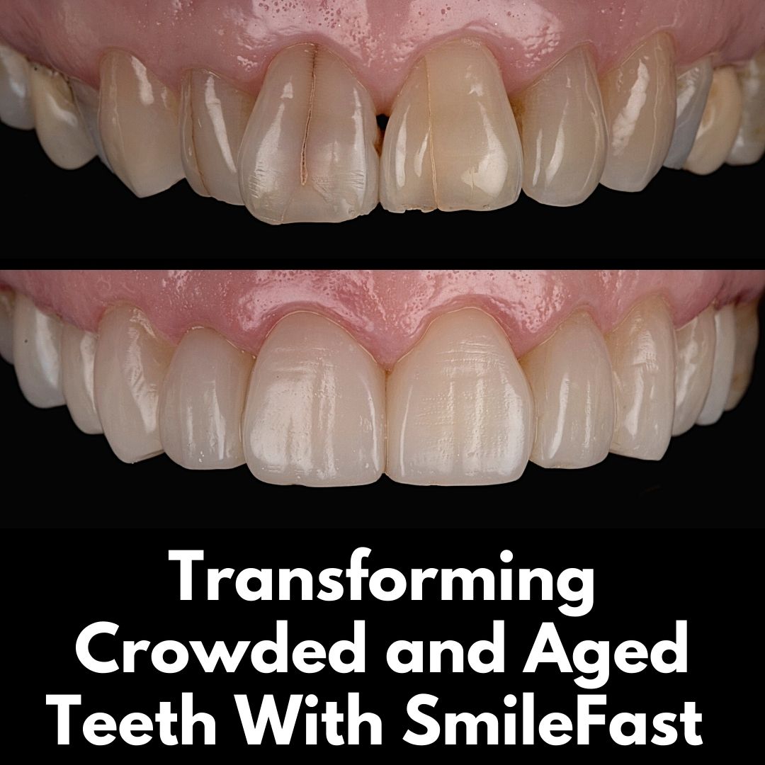 Oris Dental & Implant Studio SmileFast