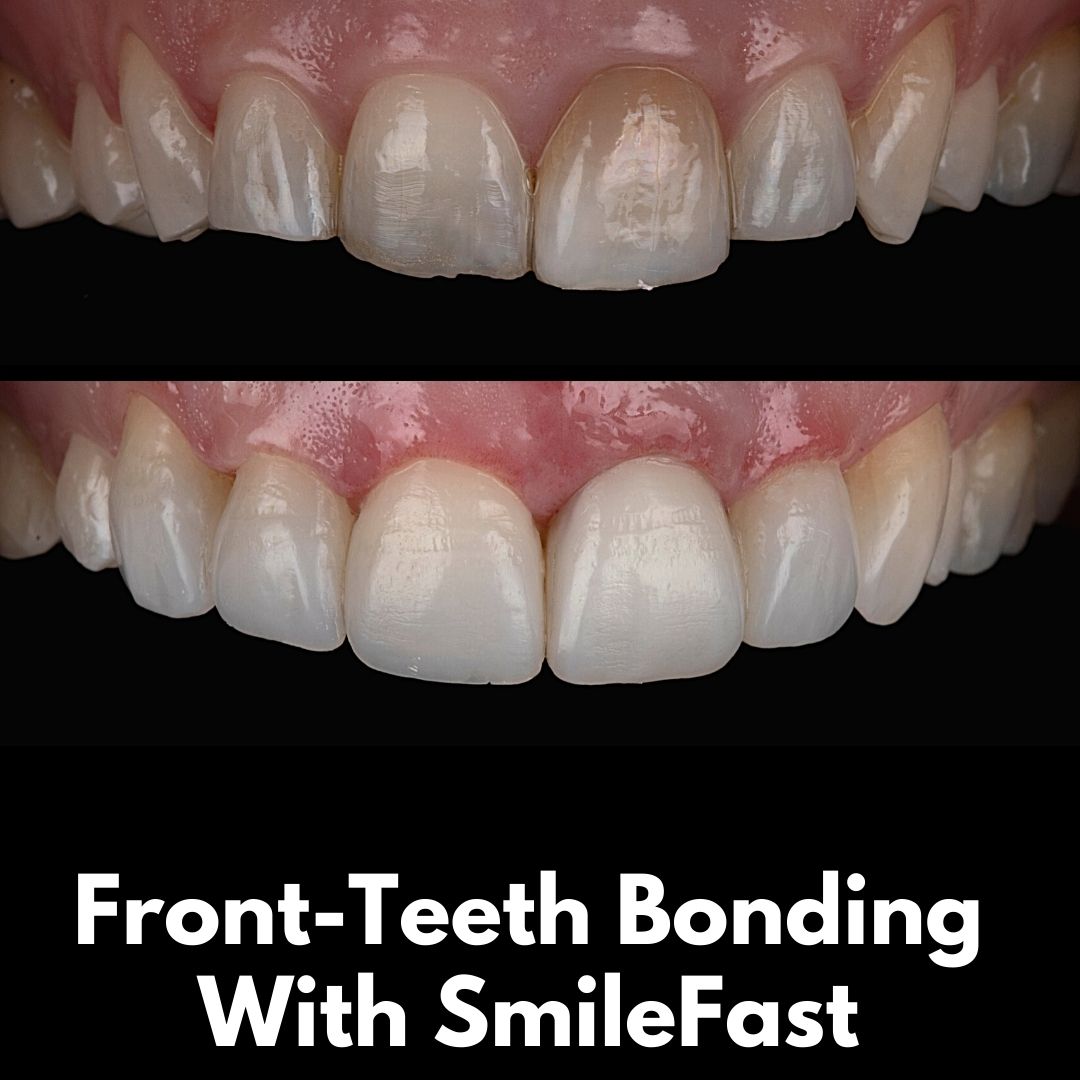 Oris Dental & Implant Studio SmileFast