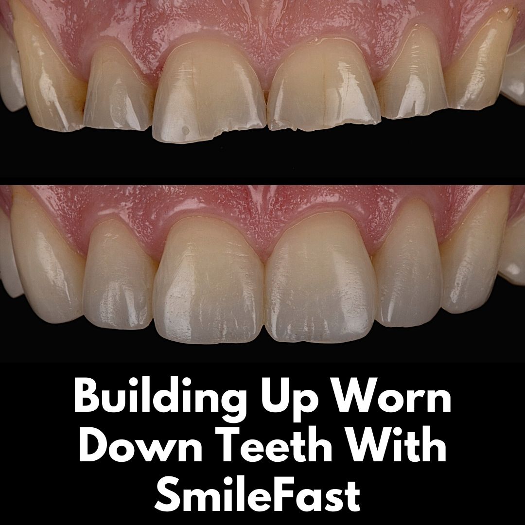 Oris Dental & Implant Studio SmileFast