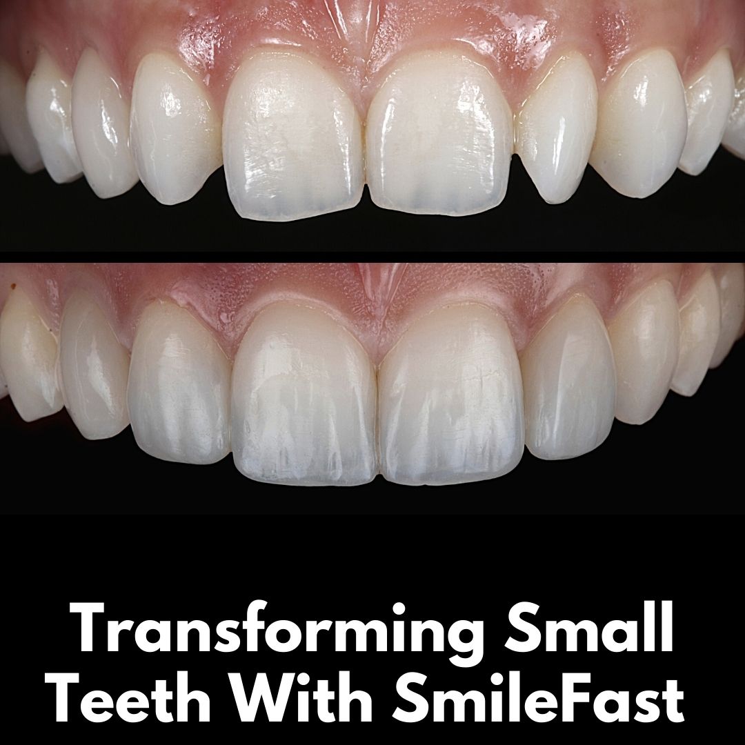 Oris Dental & Implant Studio SmileFast