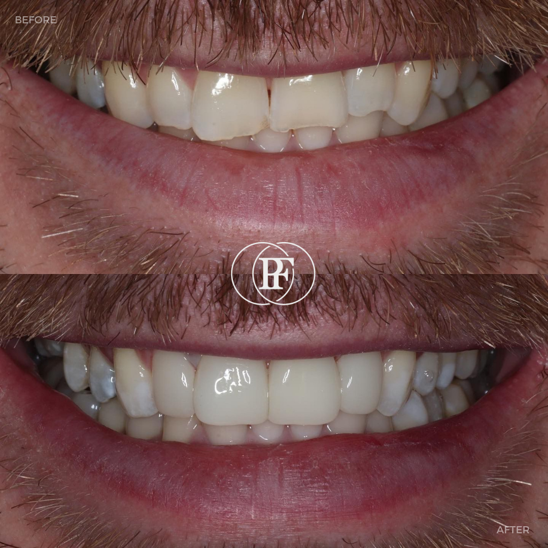Oris Dental & Implant Studio Smile Gallery