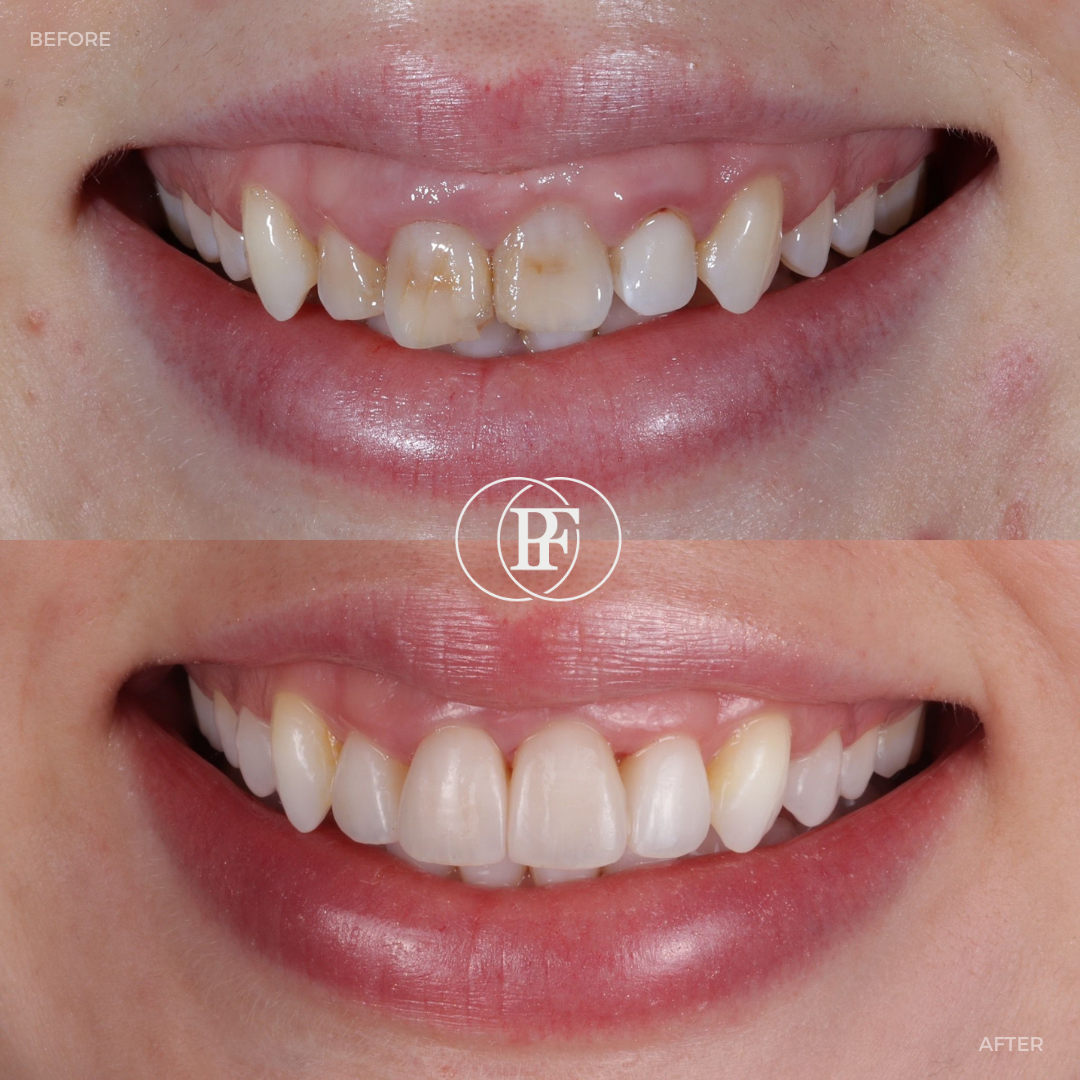 Oris Dental & Implant Studio Smile Gallery
