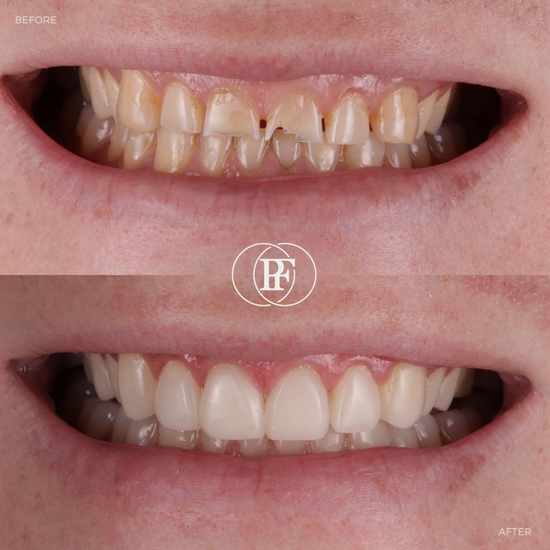 Oris Dental & Implant Studio Smile Gallery