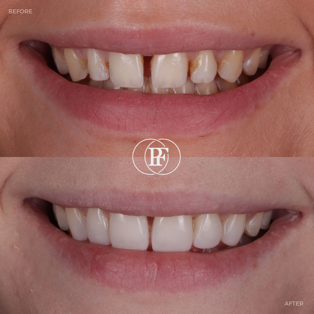 Oris Dental & Implant Studio Smile Gallery