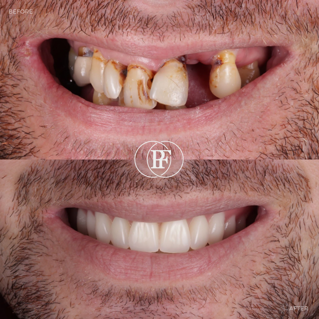 Oris Dental & Implant Studio Smile Gallery
