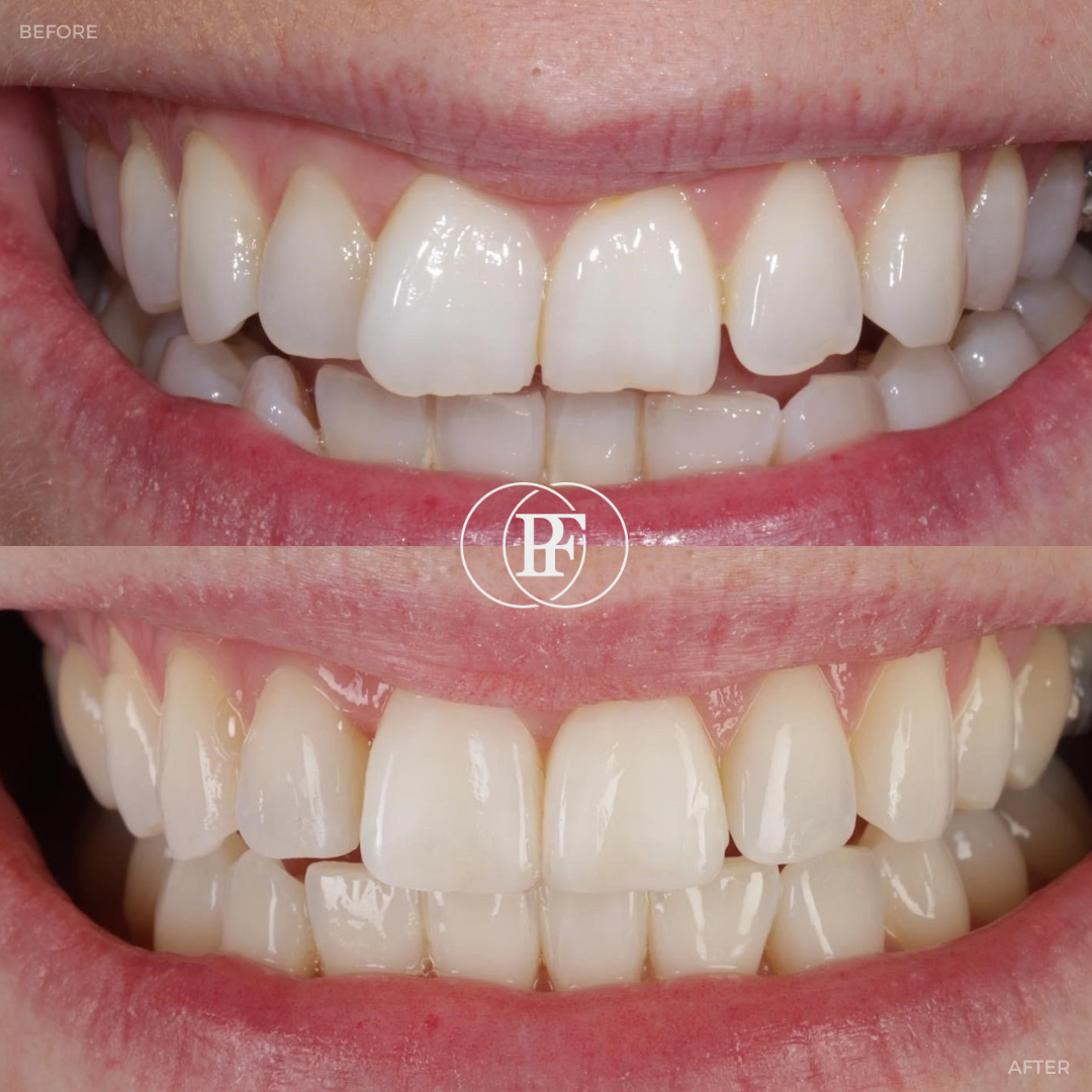 Oris Dental & Implant Studio Smile Gallery