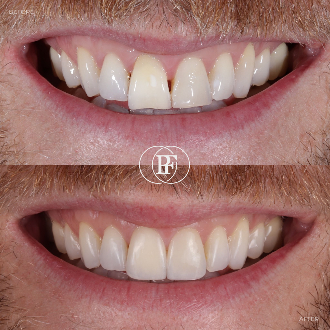 Oris Dental & Implant Studio Smile Gallery
