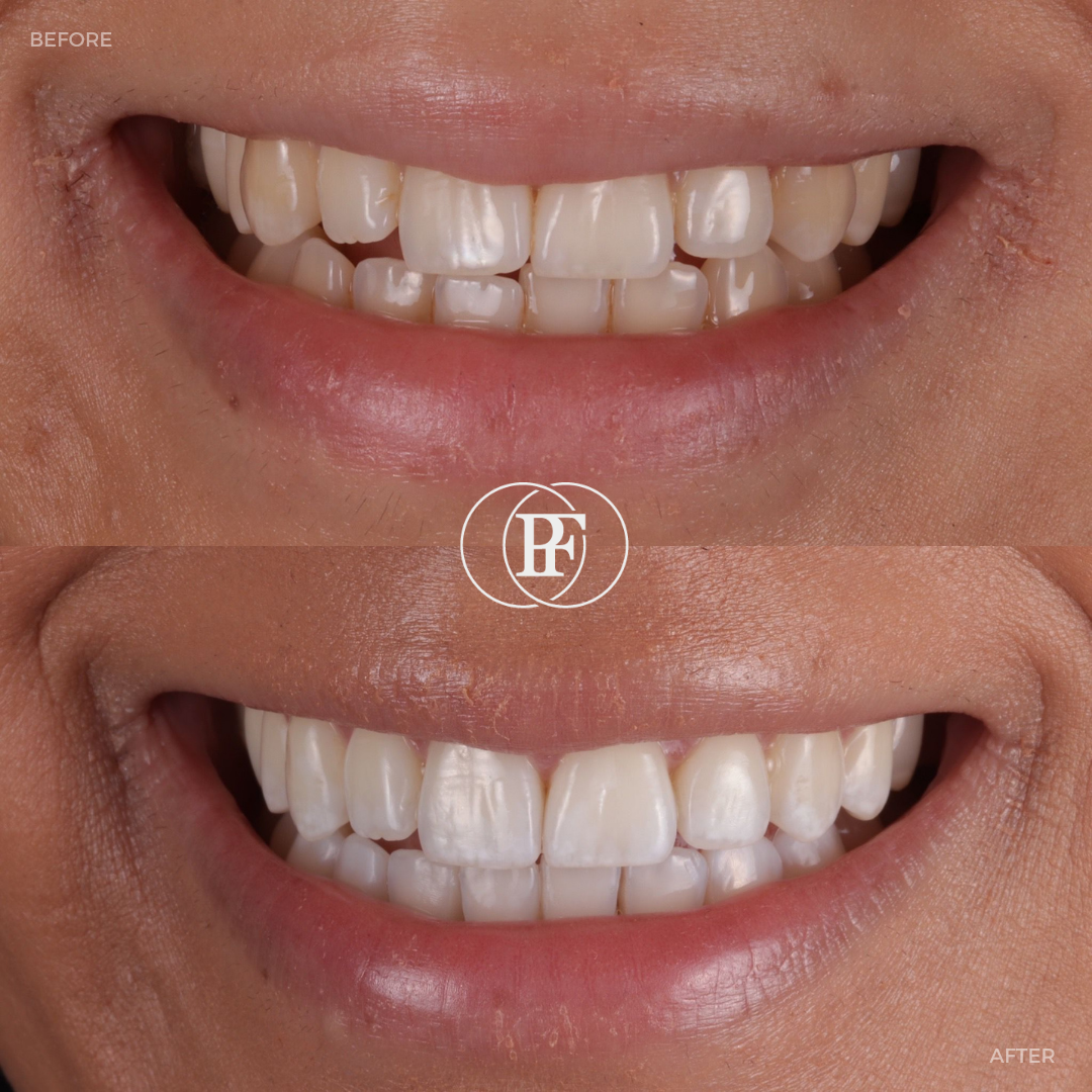 Oris Dental & Implant Studio Smile Gallery