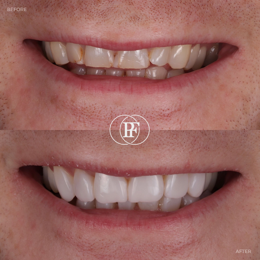 Oris Dental & Implant Studio Smile Gallery