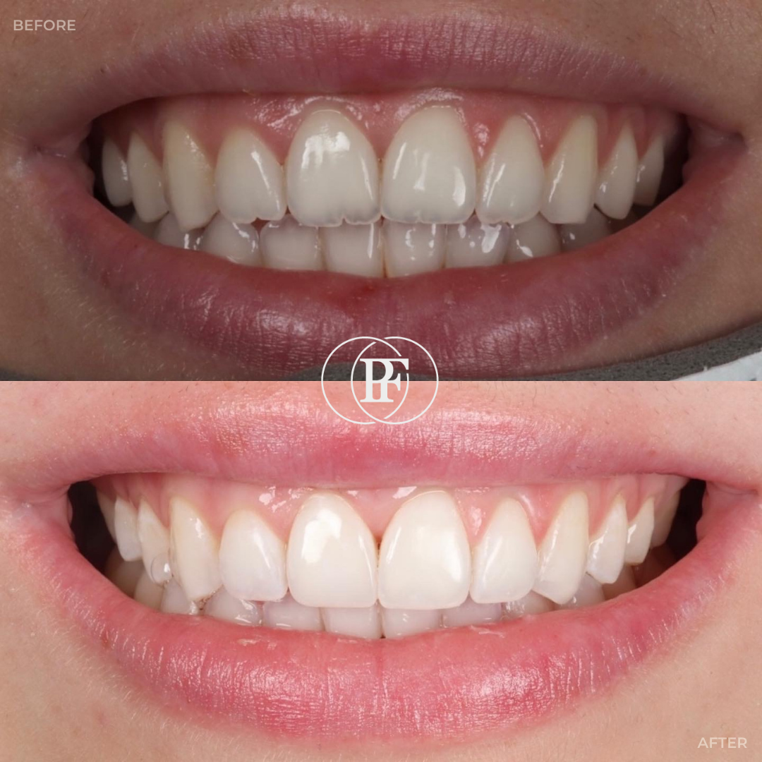 Oris Dental & Implant Studio Smile Gallery