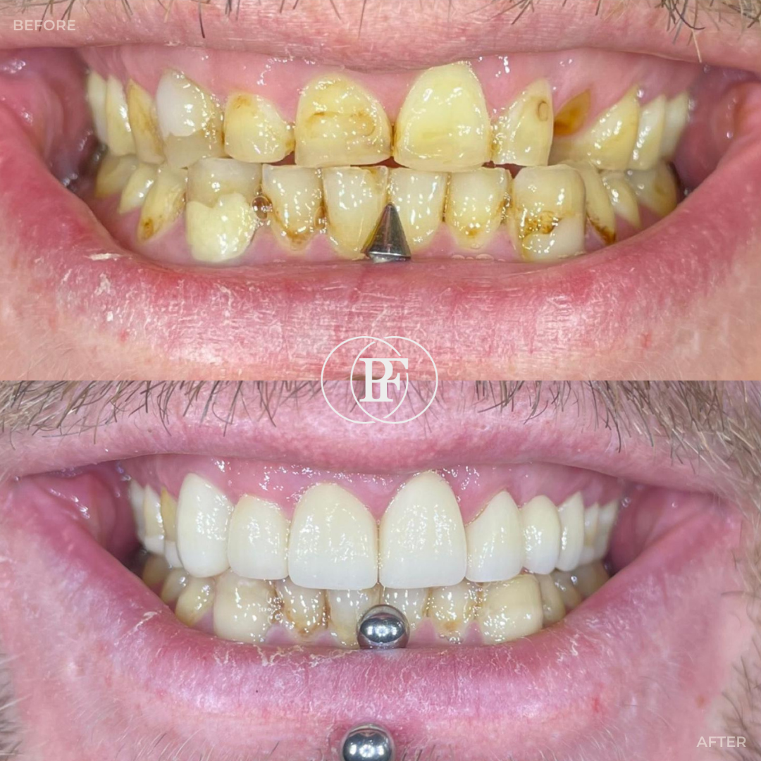 Oris Dental & Implant Studio Smile Gallery