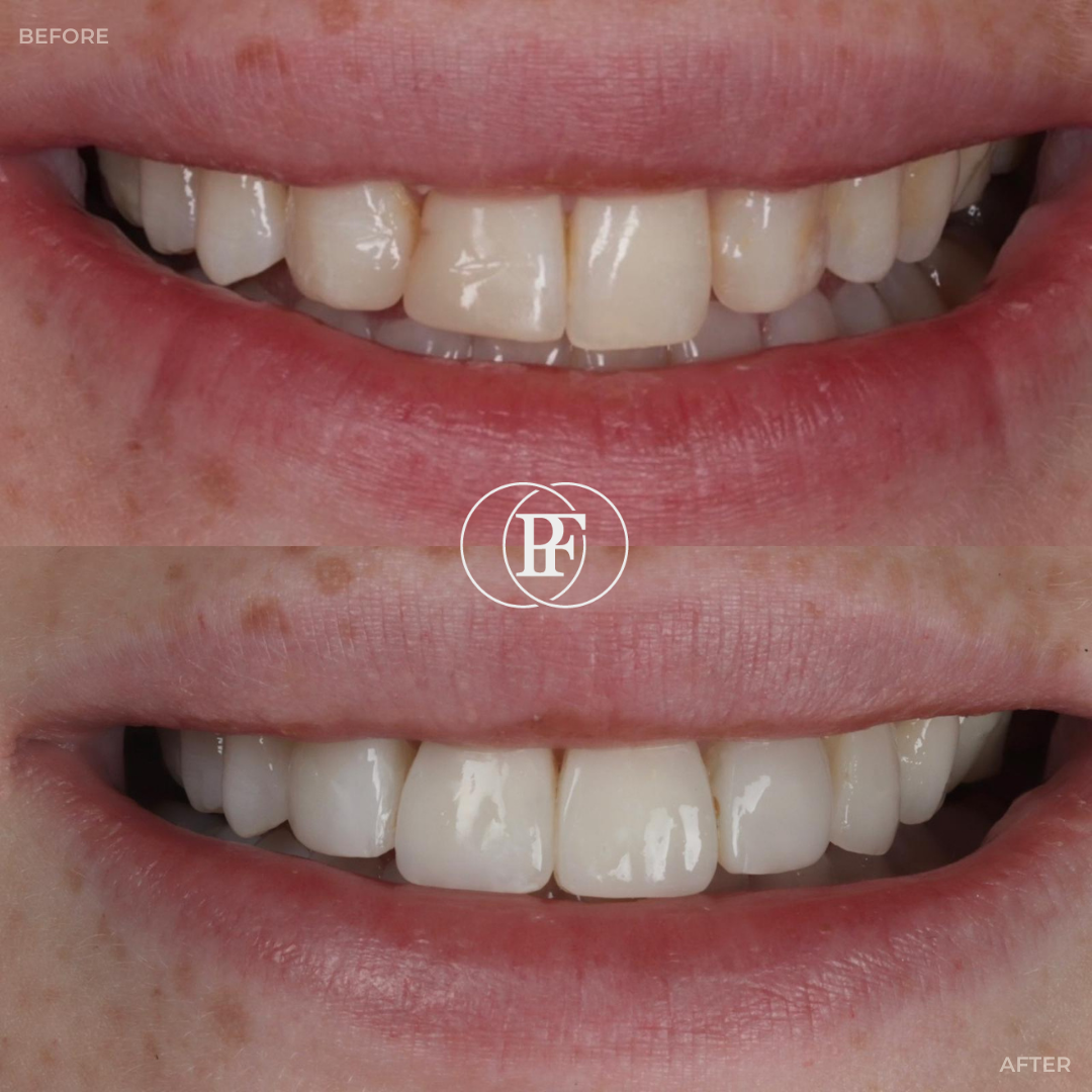 Oris Dental & Implant Studio Smile Gallery