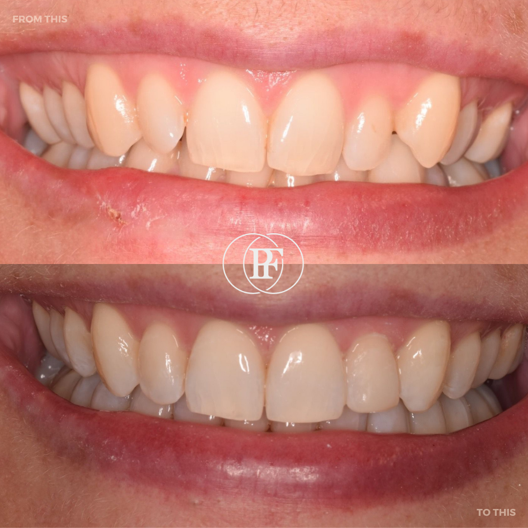 Oris Dental & Implant Studio Smile Gallery