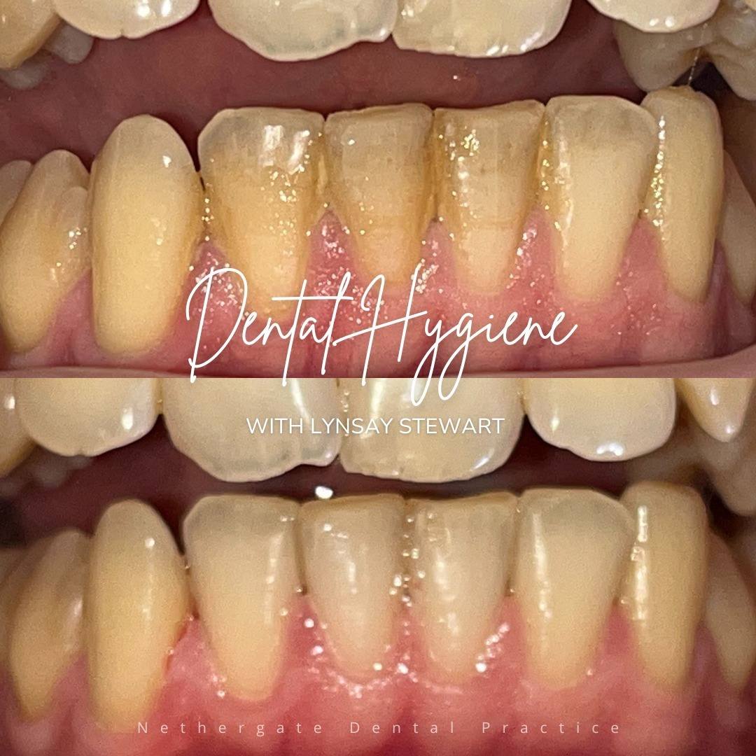 Oris Dental & Implant Studio Dental Hygiene Oris Dental & Implant Studio Dental Hygiene