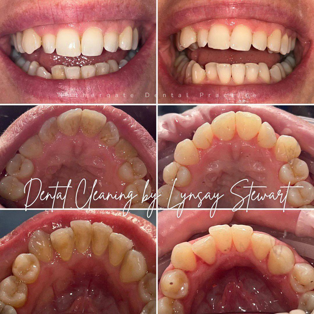 Oris Dental & Implant Studio Dental Hygiene Oris Dental & Implant Studio Dental Hygiene