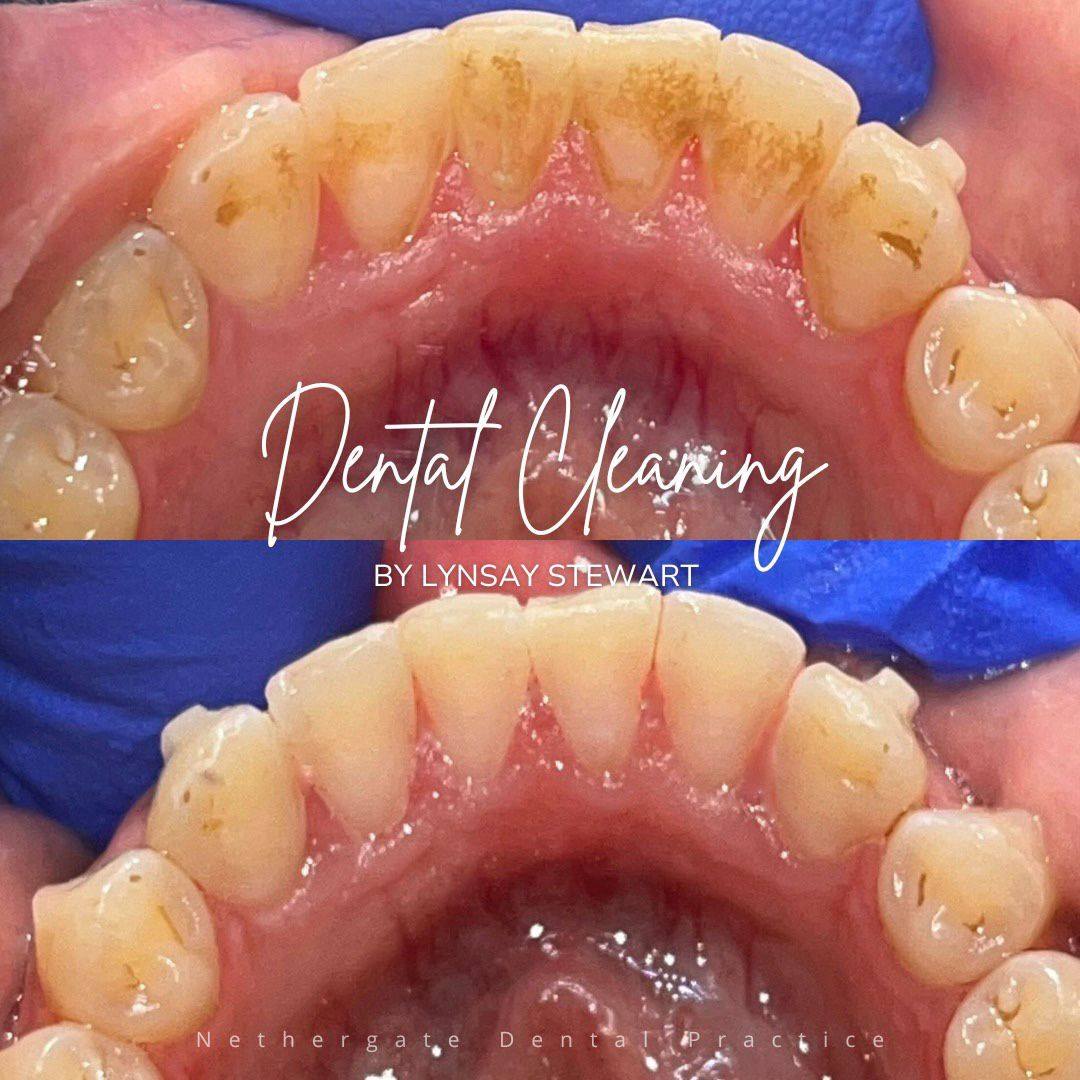Oris Dental & Implant Studio Dental Hygiene Oris Dental & Implant Studio Dental Hygiene
