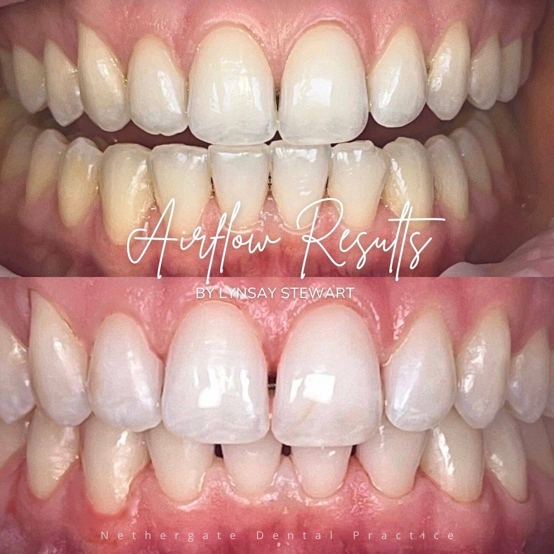 Oris Dental & Implant Studio Dental Hygiene Oris Dental & Implant Studio Dental Hygiene