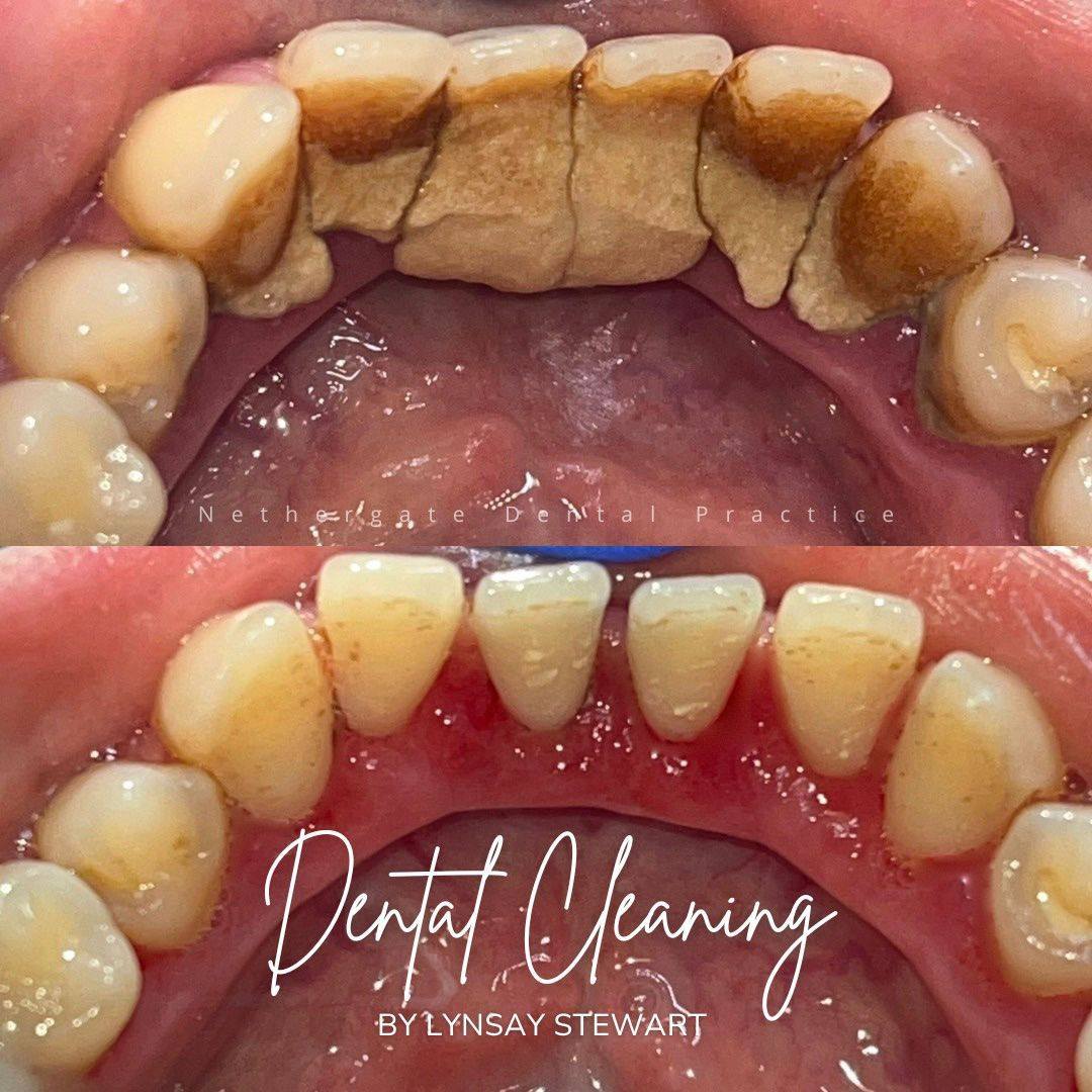 Oris Dental & Implant Studio Dental Hygiene Oris Dental & Implant Studio Dental Hygiene