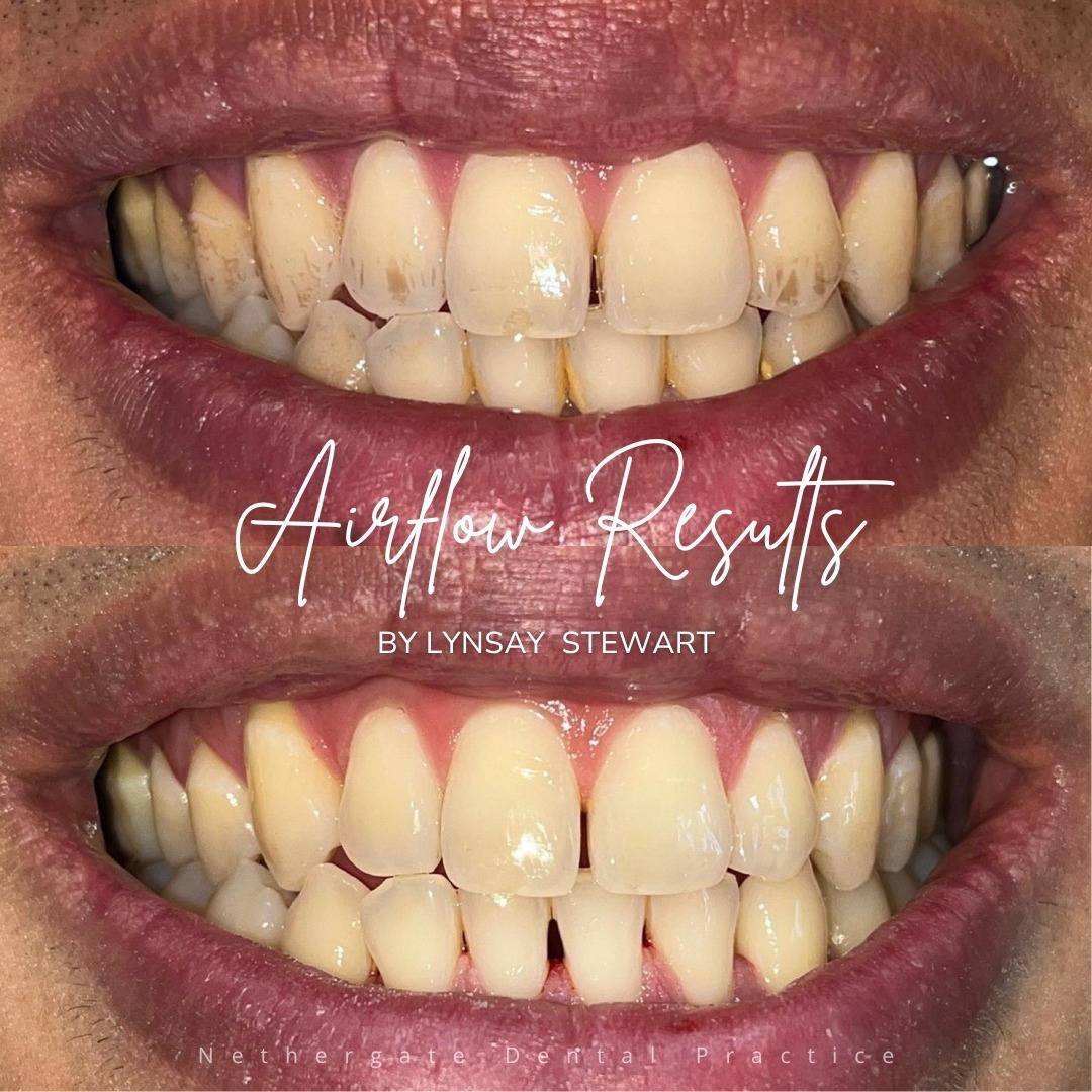 Oris Dental & Implant Studio Dental Hygiene Oris Dental & Implant Studio Dental Hygiene
