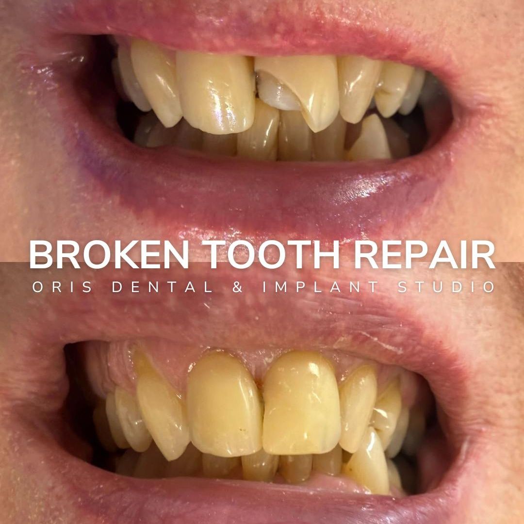 Oris Dental & Implant Studio Smile Gallery