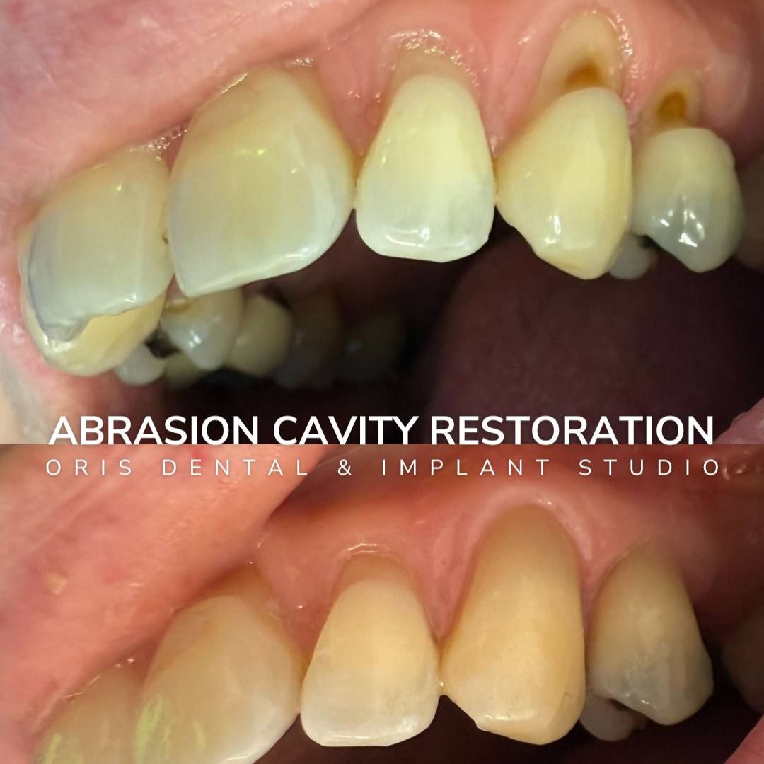 Oris Dental & Implant Studio Smile Gallery