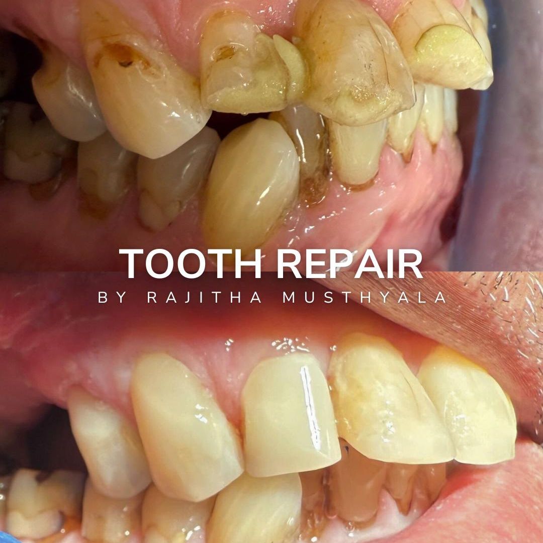 Oris Dental & Implant Studio Smile Gallery