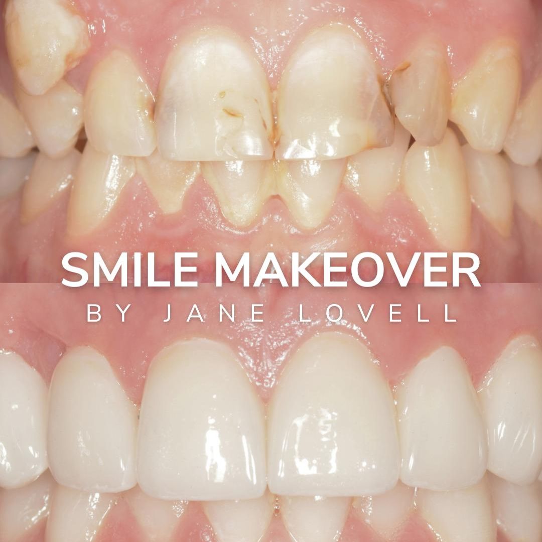 Oris Dental & Implant Studio Smile Gallery