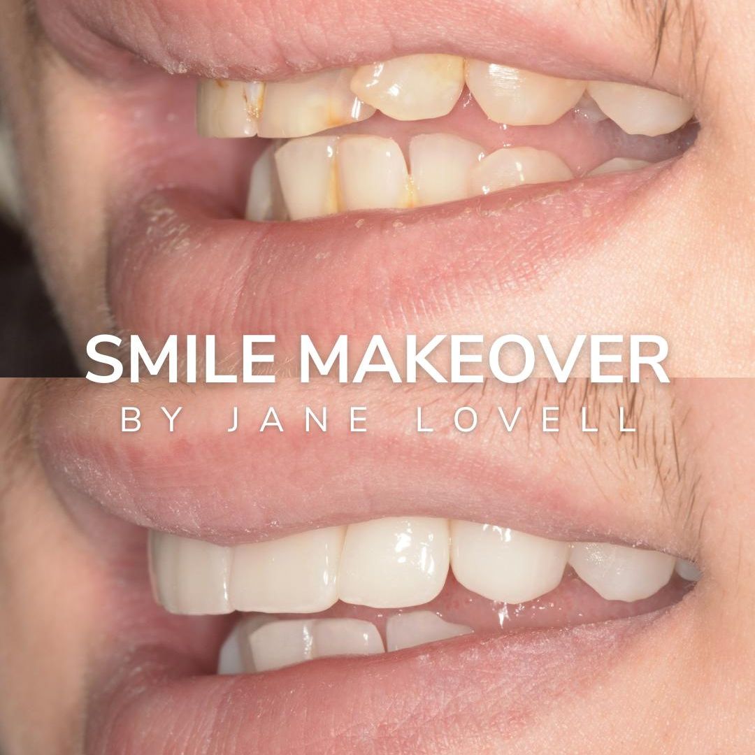 Before and after dental treatment oris dental