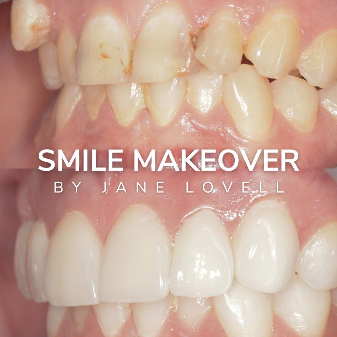 Before and after dental treatment oris dental